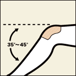ひざを35°〜45°まげた状態で貼る