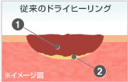 ドライヒーリングイメージ