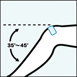 ひざを35°〜45°まげた状態で貼る