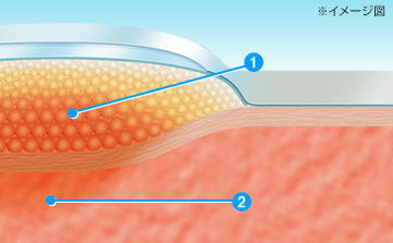 絆創膏とキズの断面図（イメージ図）