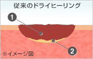 ドライヒーリングイメージ